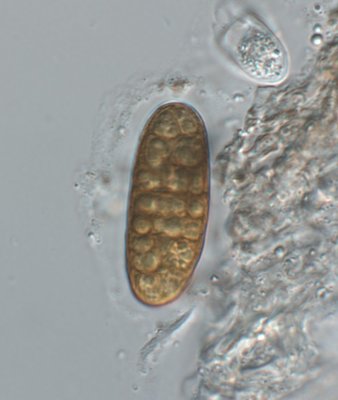 Aufnahme-1705_comp.jpg (75.5 KiB) 52823 mal betrachtet Hysterographium fraxini