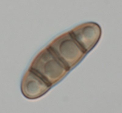 Aufnahme-1319comp.jpg (20.31 KiB) 52809 mal betrachtet Hysterium angustatum auf Betula