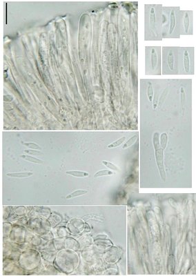Orbilia alpigena, 6.V.2016-2.jpg