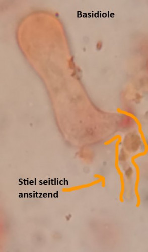 Radulomyces_rickii_Basidiole01.jpg