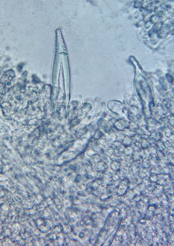 Hohenbuehelia geogenia;Metuloide;Obj.40x.jpg