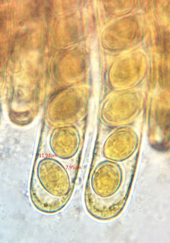Pyronema omphalodes;Sporen in Ascus;J-.jpg