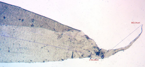 Hylocomium splendens;Stengelblatt;Spitze;Obj.4x.jpg