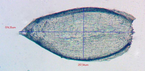 Hylocomium splendens;Astblatt;Obj.10x.jpg