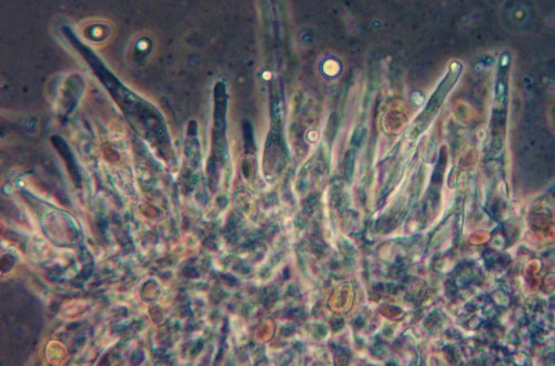 Psathyrella piluliformis;Zyst.,Obj.40xPhK.jpg