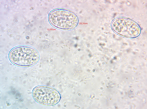 Scutellinia b. Tub.;Sporen;Obj.100xÖl.jpg