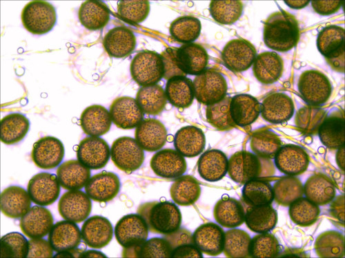 Diderma niveum (Rostaf.) t. Macbr.<br />Sp. warzig, 9 - 12 µ Durchm.