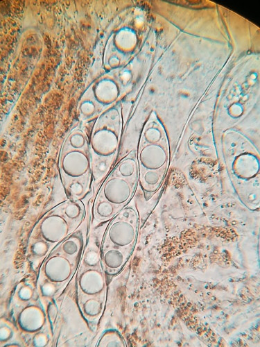 Gyromitra ancillis mehrfach Sporen.jpg