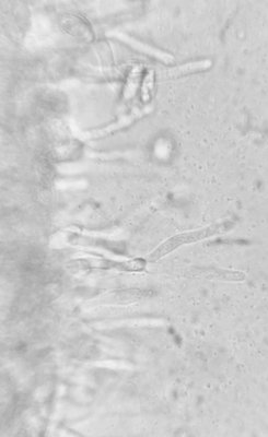 clitopilus07_Cheilocystiden.jpg
