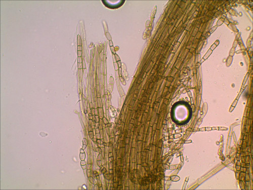 Geoglossum_Stiel_Hyphen_400-1 (2).jpg