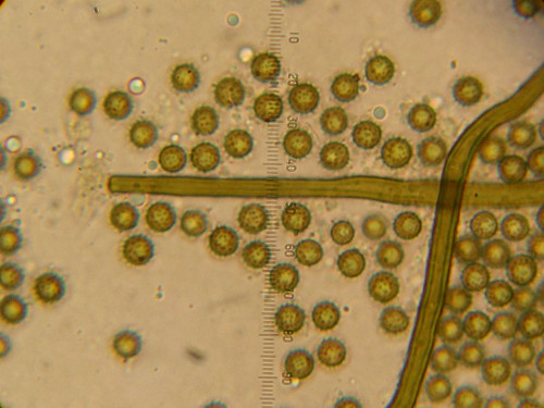 Lycoperdon_cretaceum210913mic01.JPG