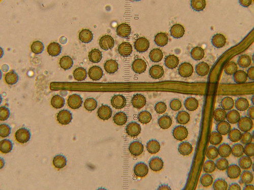 Lycoperdon_cretaceum210913mic02.JPG