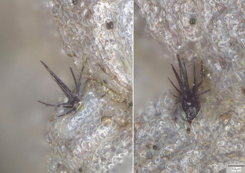 as_Pleospora_aff_leptosphaerulinoides.jpg