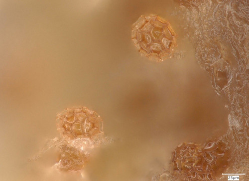 as_Tuber fulgens.jpg