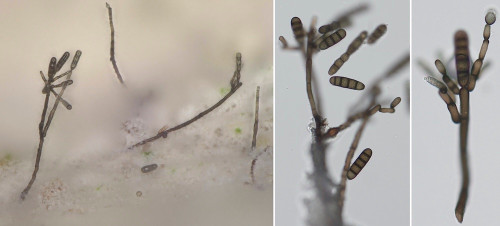 as_Kirschsteiniothelia atra.jpg